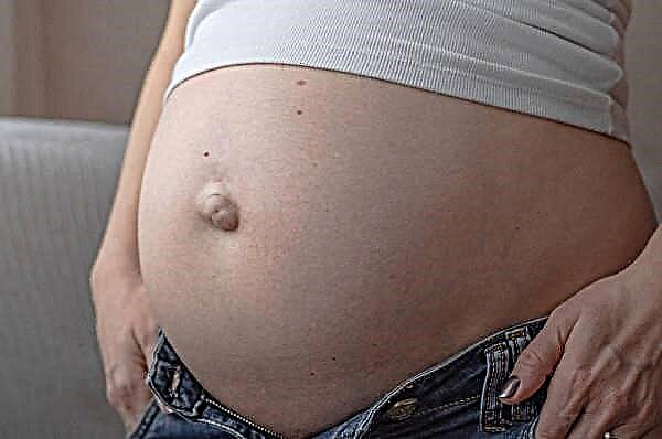 Hur man behandlar ett navelbråck under graviditeten