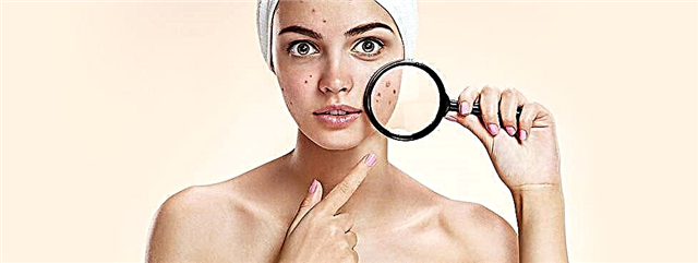 Wat is slecht voor een gevoelige huid?