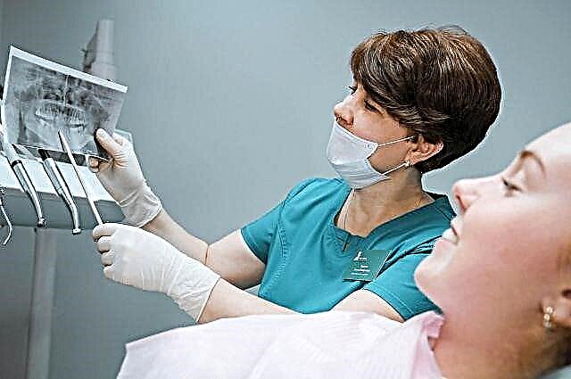Gratis tannbehandling under CHI-policyen: et lønnsomt tilbud fra NAVA tannlege